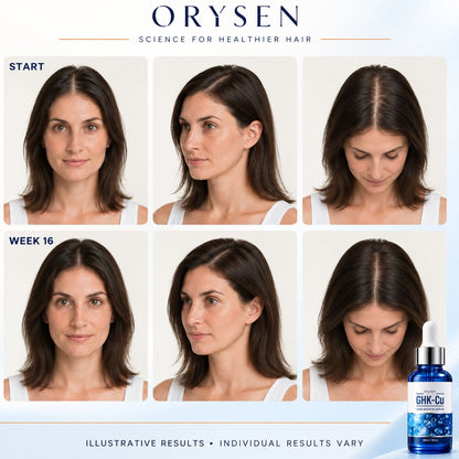 Orysen Peptide Hair Growth Serum