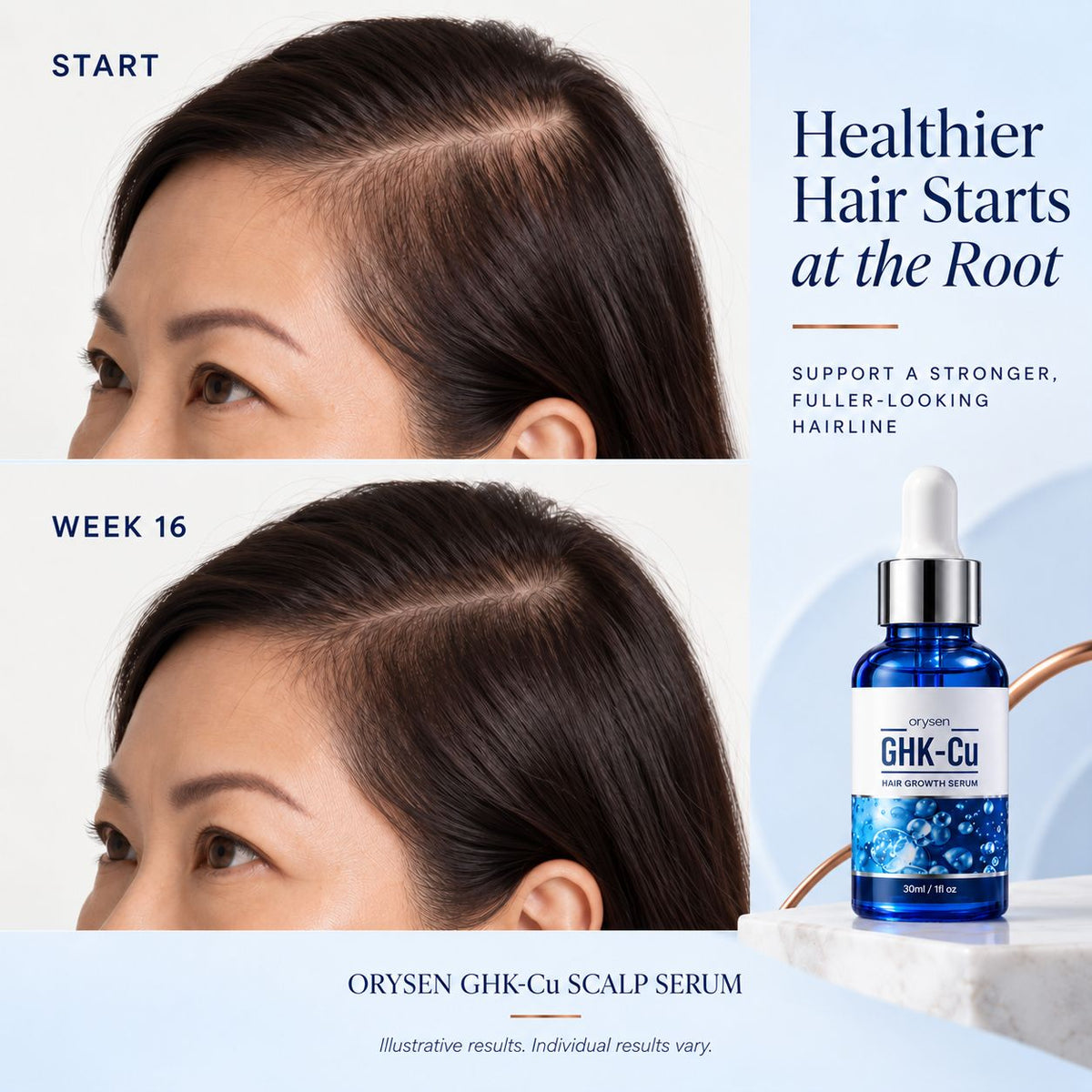 Orysen Peptide Hair Growth Serum