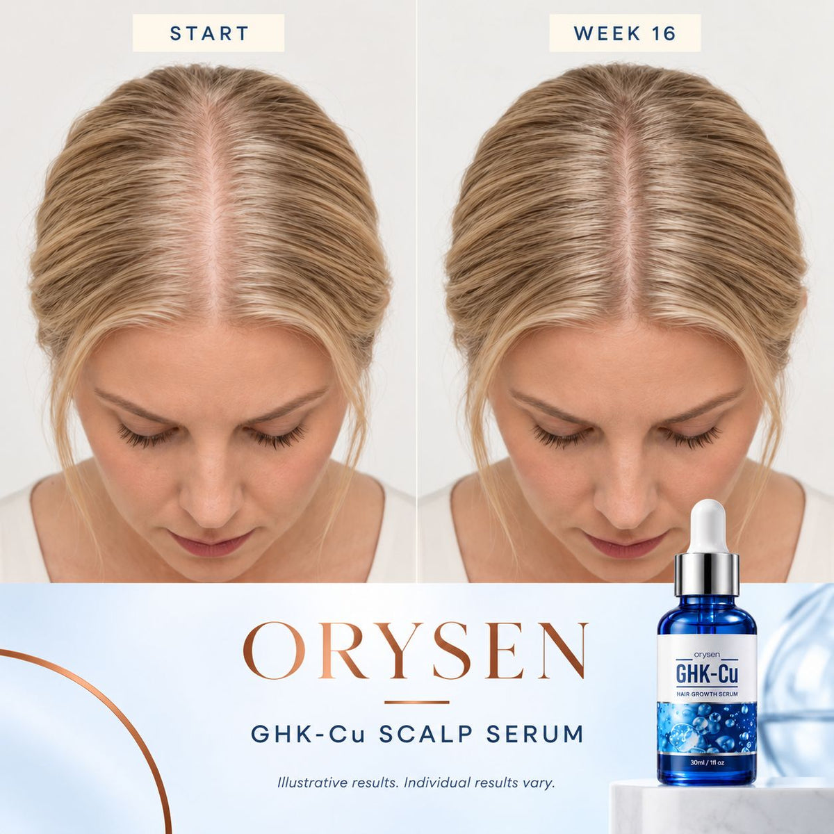 Orysen Peptide Hair Growth Serum